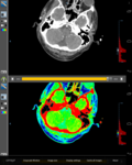 Droid DICOM Viewer